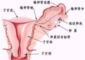 多發性子宮肌瘤