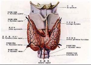 橋本式甲狀腺炎