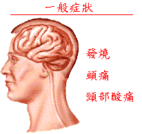 細菌性腦膜炎