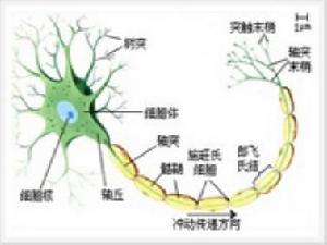 進行性肥厚性間質性神經炎