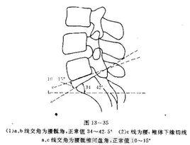 腰骶角