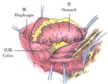 示意圖10:胃、結腸、大網膜等腹內臟器