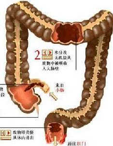 老年大腸腫瘤