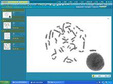 染色體圖像分析系統