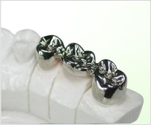 金屬鋼冠牙 金屬鋼冠牙