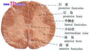 急性壞死出血性腦脊髓炎