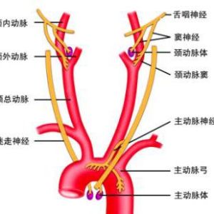 主動脈弓縮窄