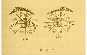 眼針療法