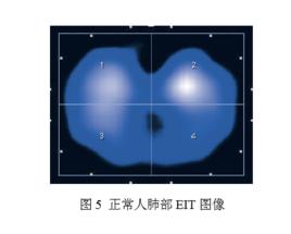 生物電阻抗斷層成像