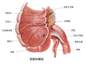 小兒急性闌尾炎