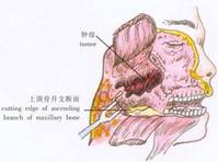 上頜骨