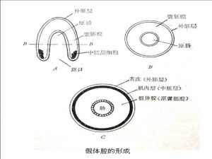 假體腔