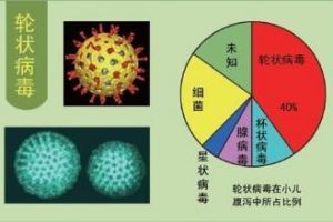 病毒性腹瀉 