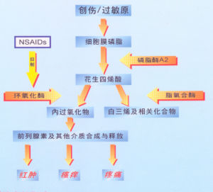 非甾體類抗炎藥物性腎病