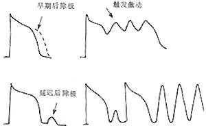 竇性期前收縮