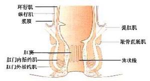 肛管狹窄