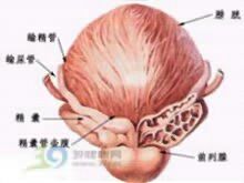 肉芽腫性前列腺炎