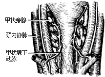 甲狀旁腺切除術