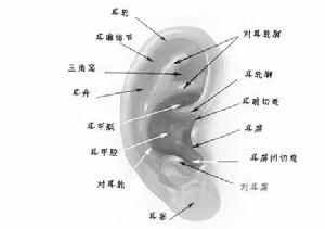 麗聲定製耳機