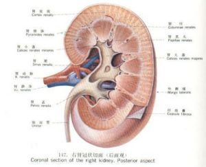 I型腎小管性酸中毒