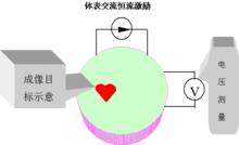 生物電阻抗成像檢測技術