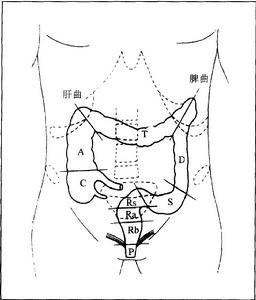 老年大腸腫瘤