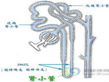 全遠端型腎小管酸中毒