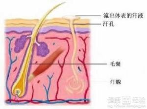 汗孔周圍炎及多發性汗腺膿腫