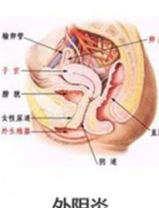 外陰痛