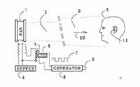 次聲波作用示意圖