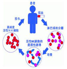 生物細胞免疫治療