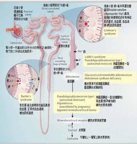 假性醛固酮症