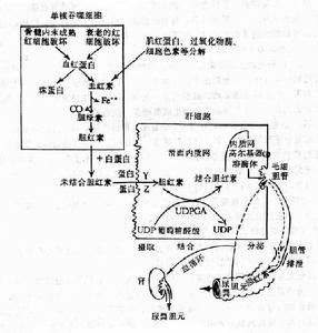 先天性非溶血性黃疸