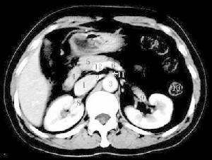 慢性腸系膜缺血