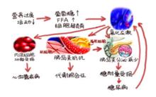 糖尿病病因