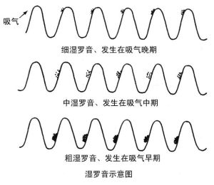 乾囉音