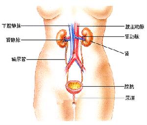 肝硬化性腎損害