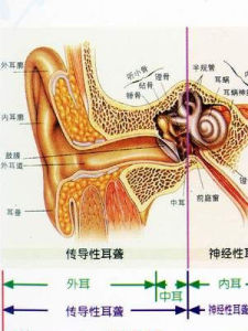 耳毒性藥物