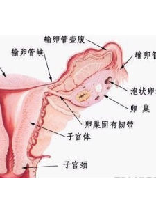 宮頸內口鬆弛症