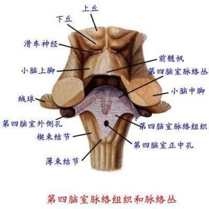 第四腦室孔閉塞綜合徵