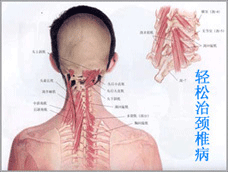 頸椎疾病