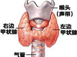 青春期甲亢