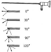 上頜竇內鏡檢查術