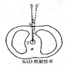 外照射治療