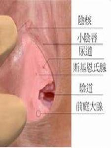 斯基恩氏腺