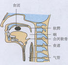 缺鐵性吞咽困難