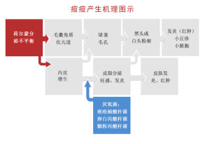 痘痘機理圖示