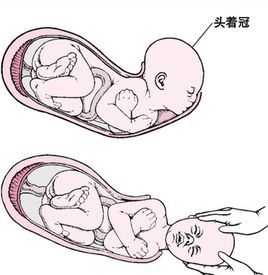 胎兒頭位