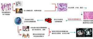 武警二院5AJ技術治療流程