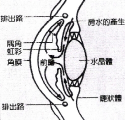 開角型青光眼